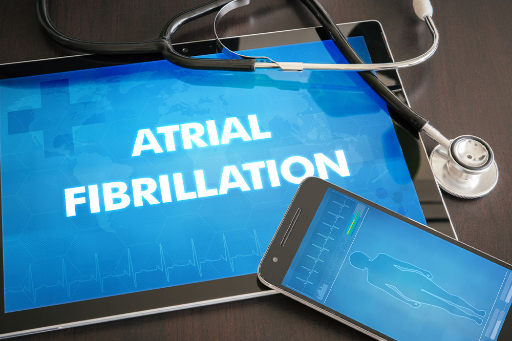 Atrial fibrillation &#8211; Causes, symptoms, and management tips